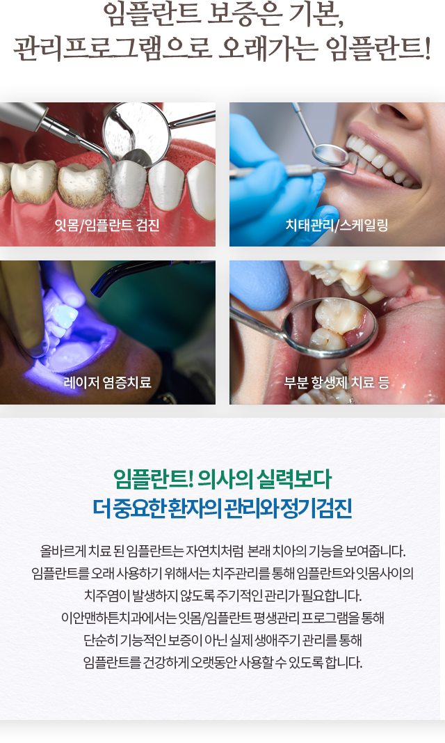 임플란트