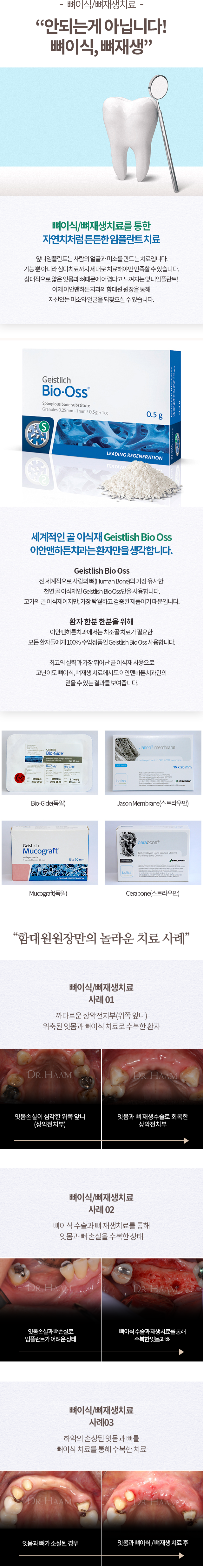 임플란트