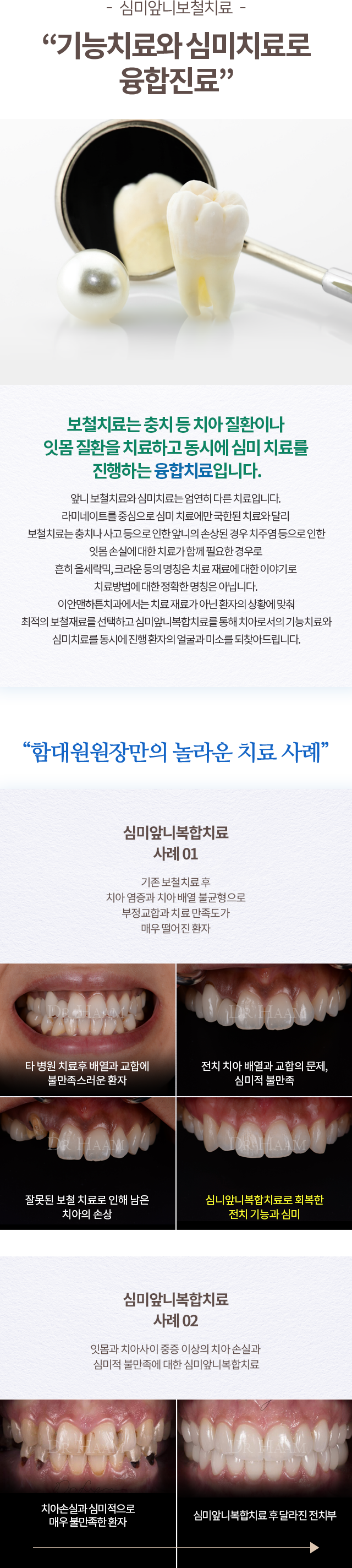 심미치료