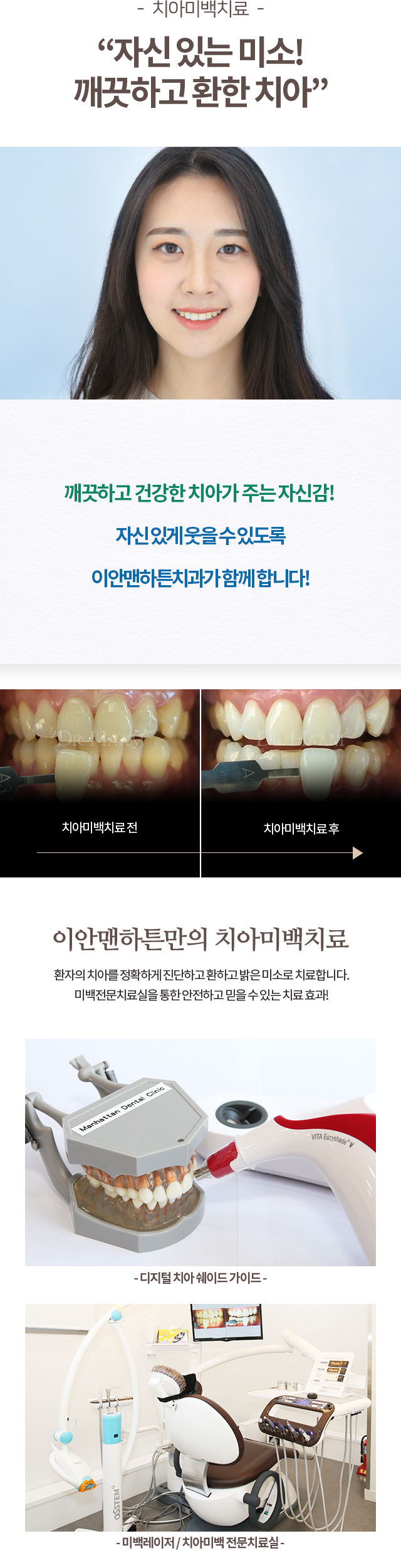 치아미백