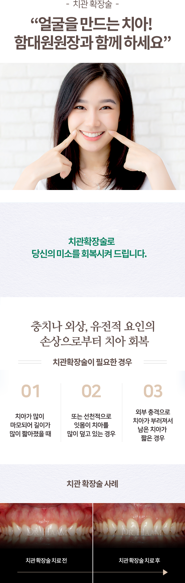 치관확장술