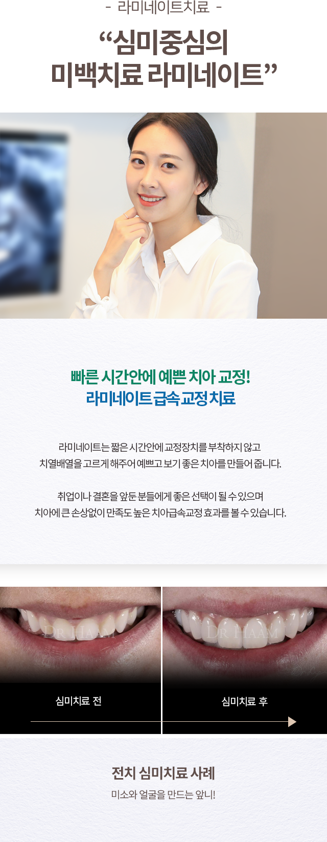 심미치료