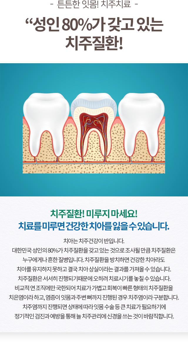 일반치료
