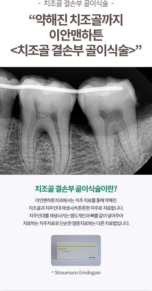 일반치료