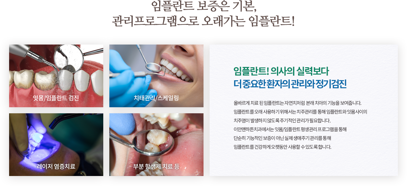 임플란트