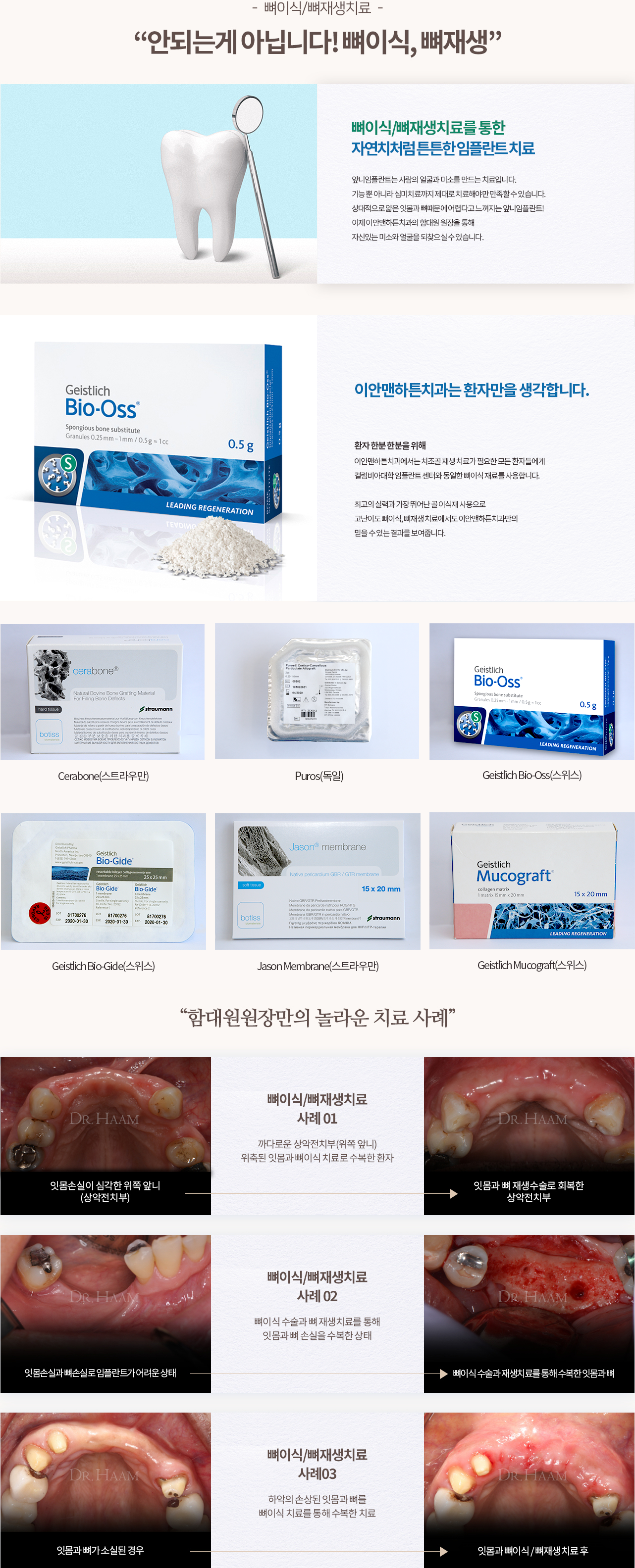임플란트