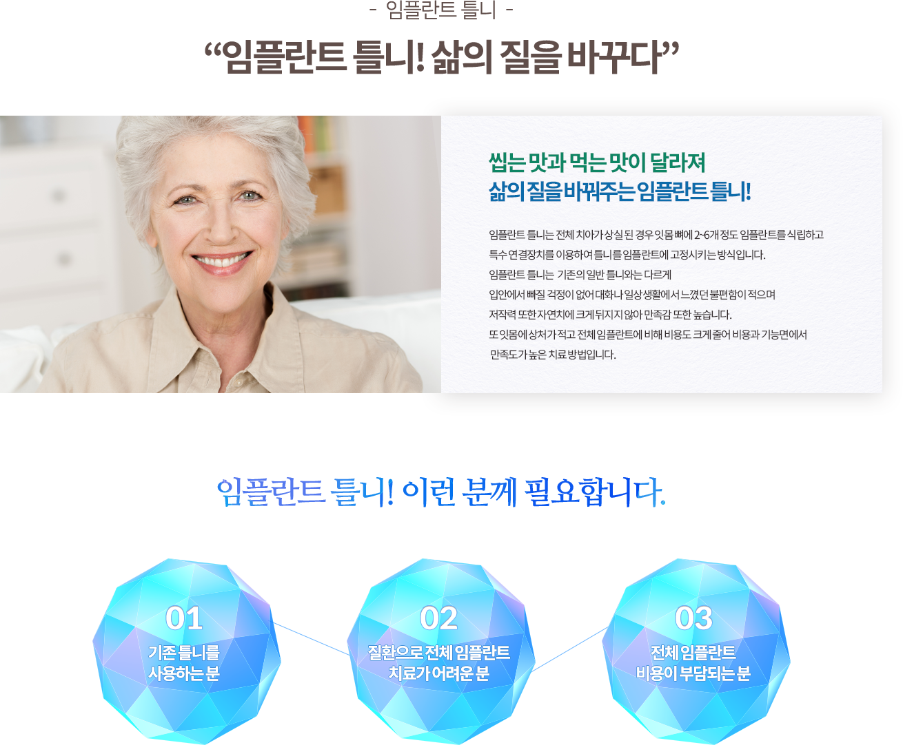 임플란트