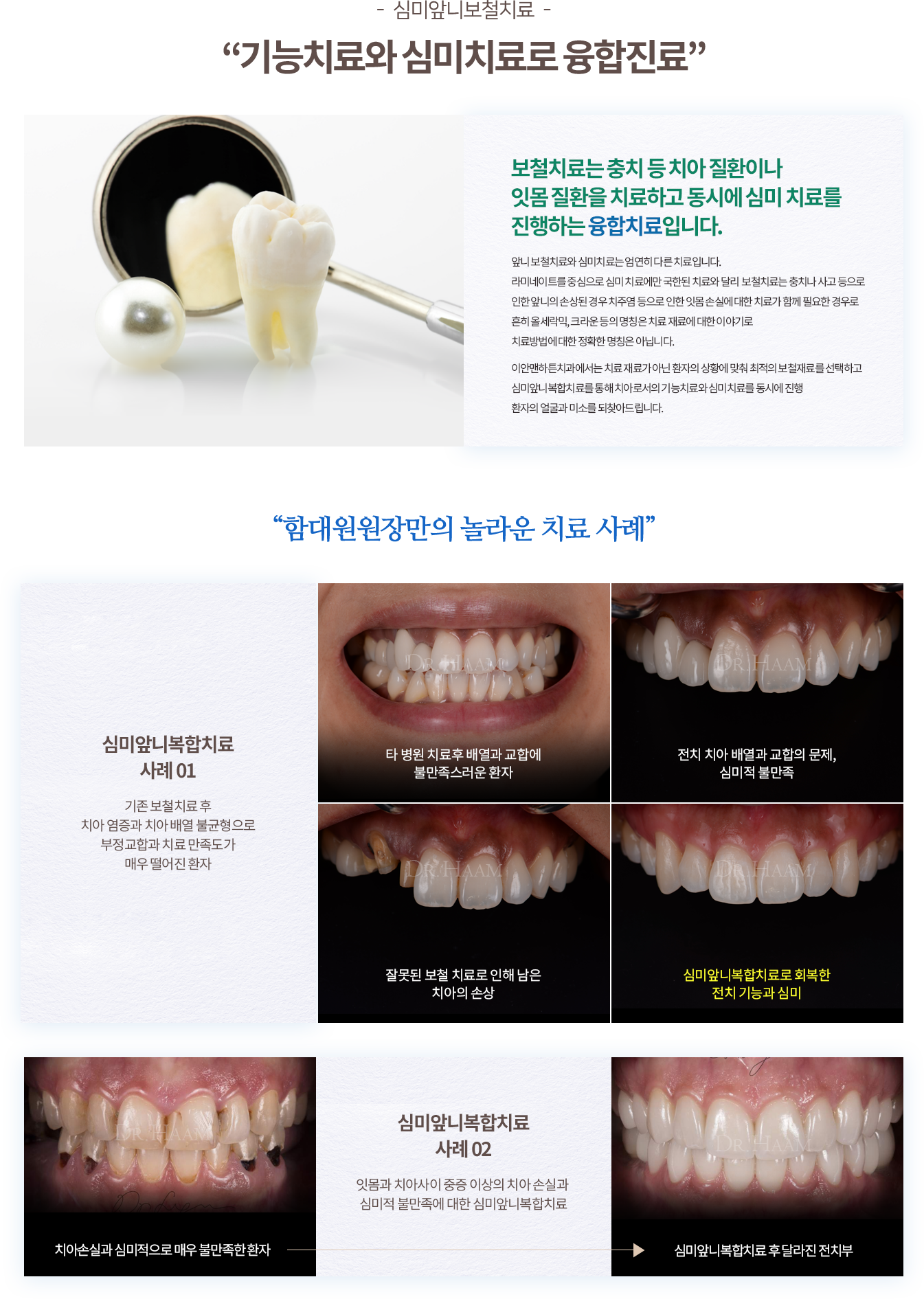 심미치료