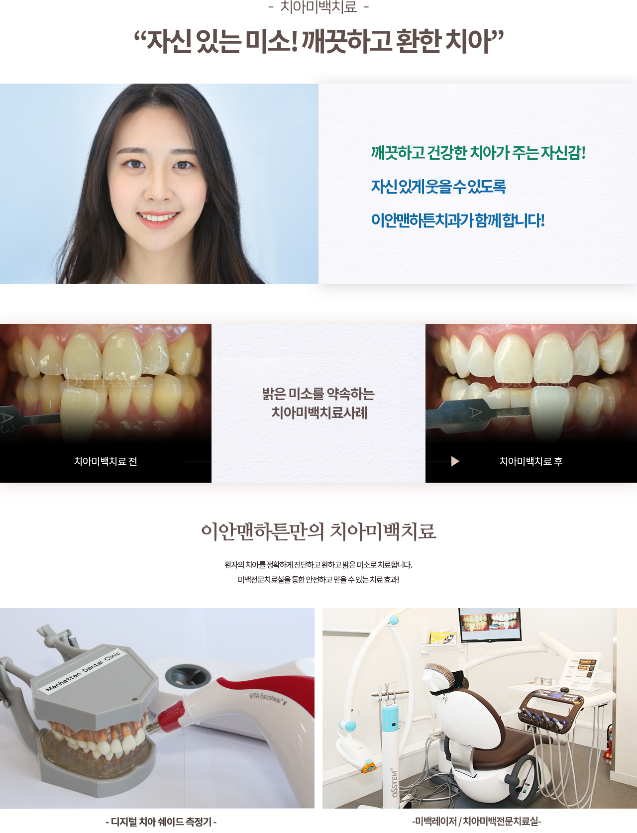 치아미백