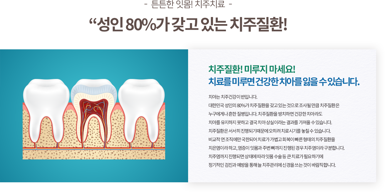 일반치료