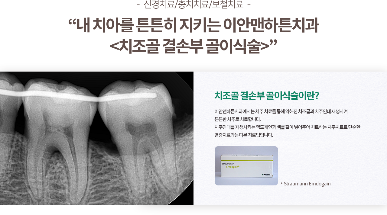 일반치료