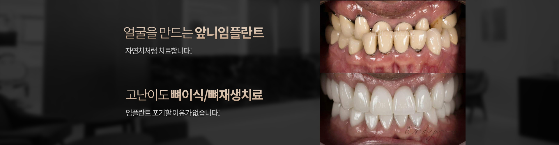 이안 맨하트 치과